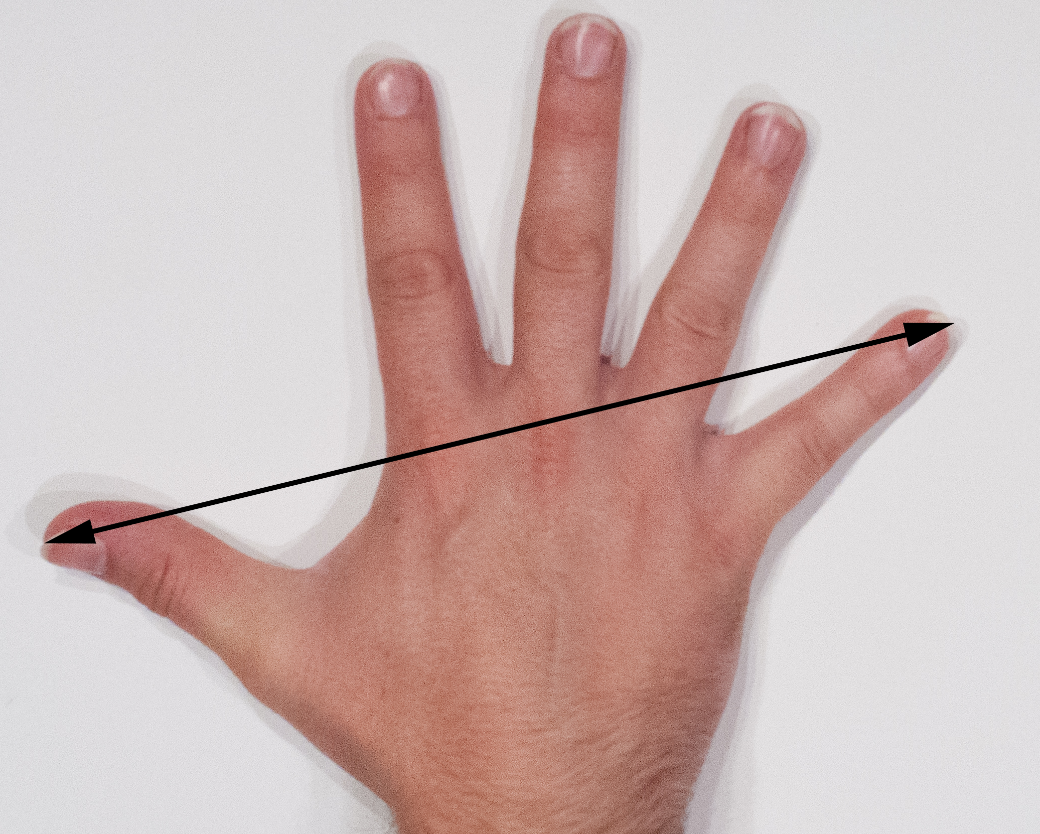 Image of a hand.